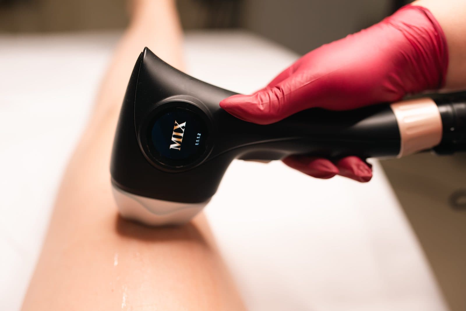 Diode laser handpiece on a leg during a treatment